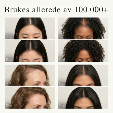 Koreansk ScalpRevive™ – Hår- & Hodebunnsbar