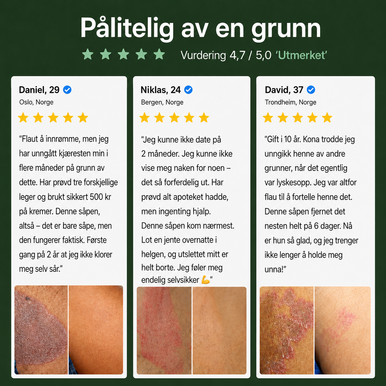 Nordic SkinBalance™ – Dyprensende kroppsbar for svetteutsatte hudområder